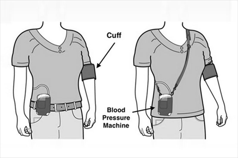ABPM (Ambulatory Blood Pressure Monitoring)