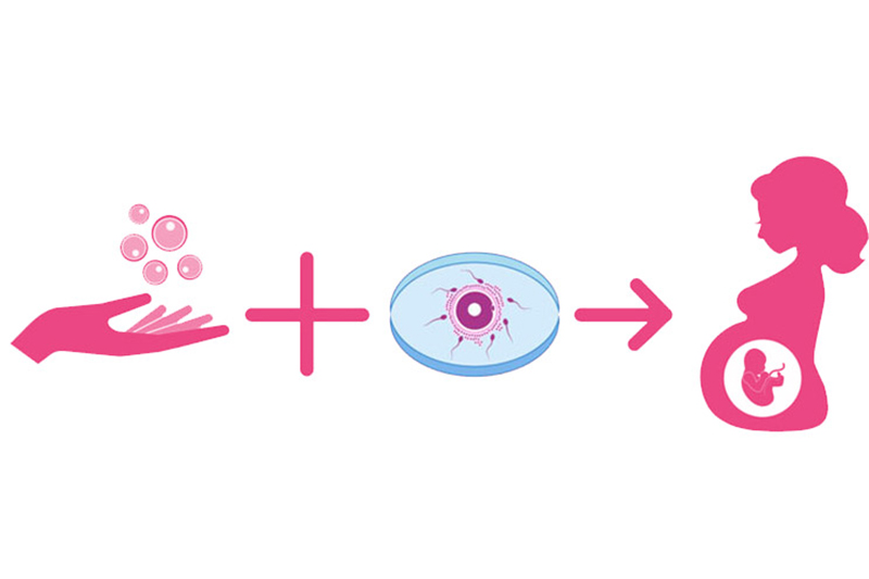 Donor sperm and Donor Oocyte