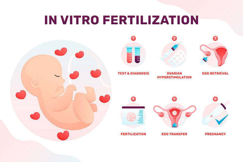 IVF/Fertility